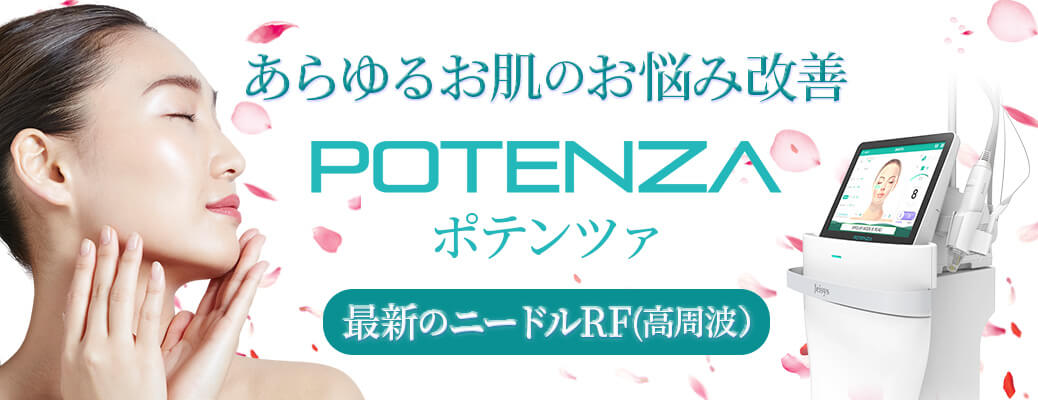 ポテンツァバナー