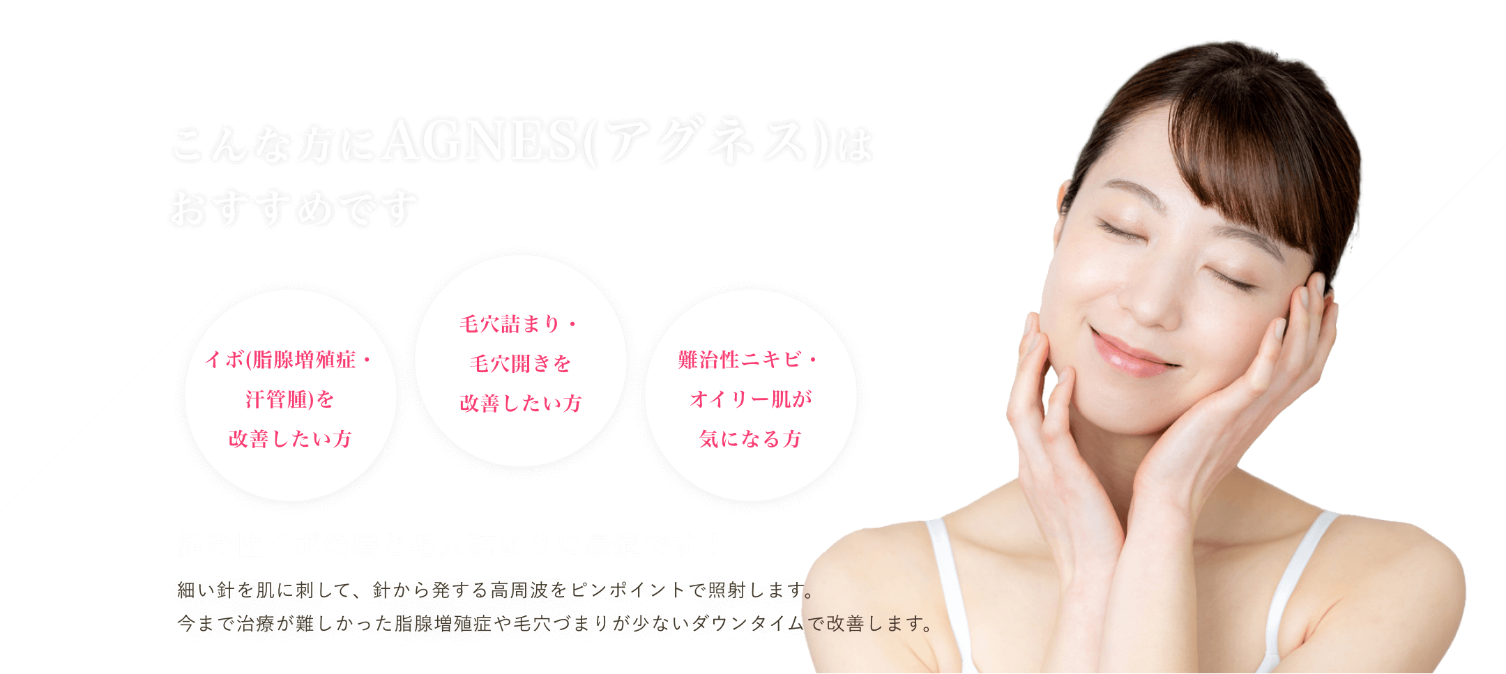 マグノリア皮膚科クリニックのAGNES(アグネス)は、難治性イボ治療と毛穴詰まりに最適です。