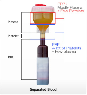 PRPをいかに濃く取るか！