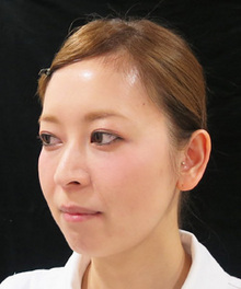 nCOG後の写真