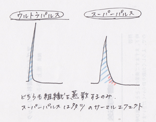 フラクショナルレーザー波形