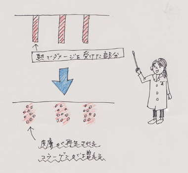 フラクショナルレーザーの種類