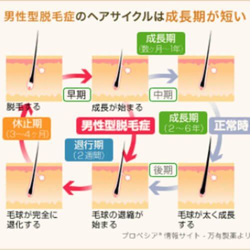 AGAとコロナウイルス