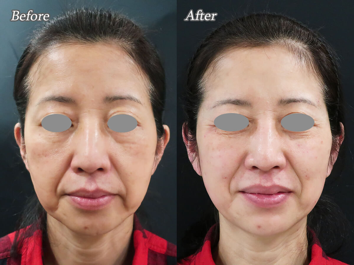  1. 肌に潤いを与える