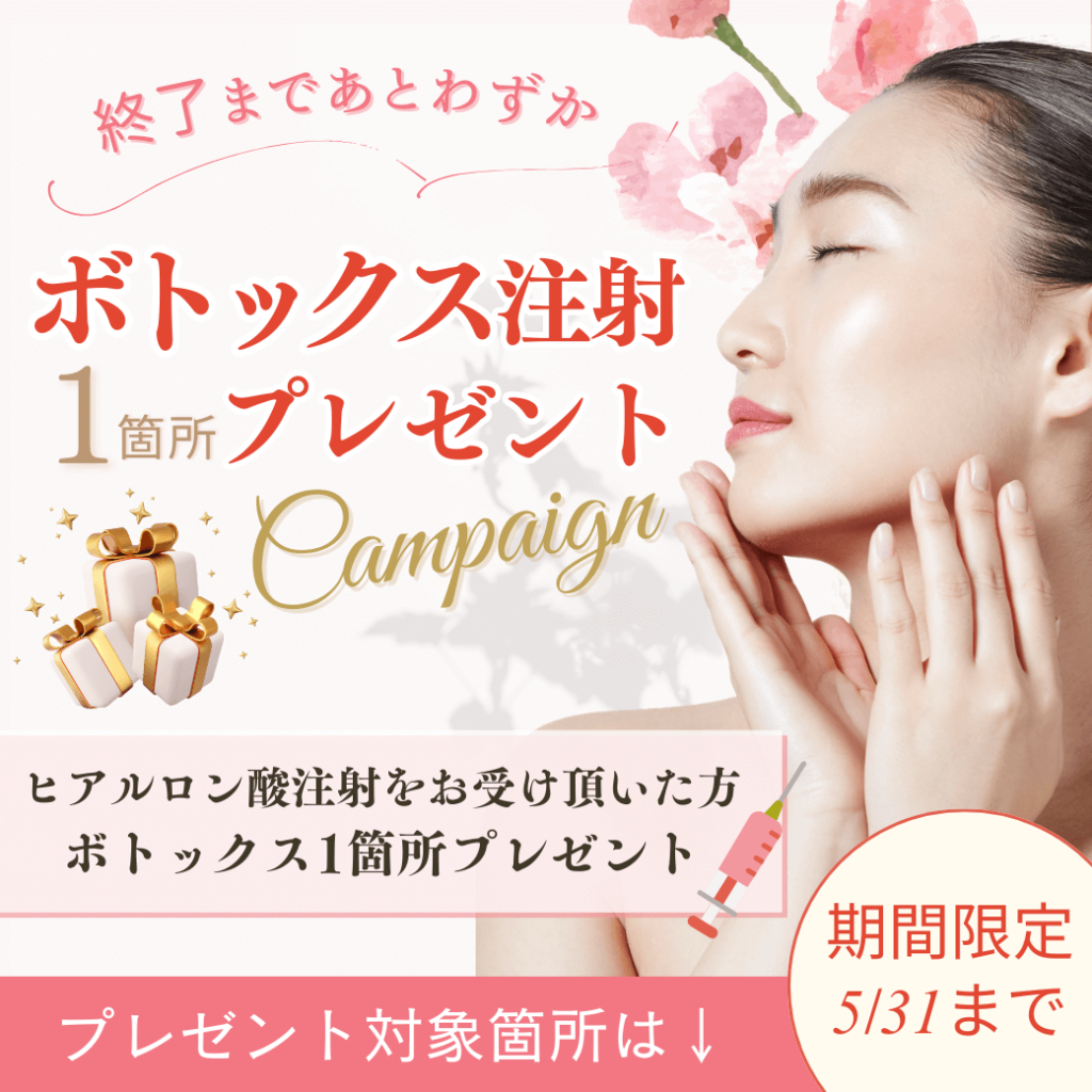 春のキャンペーン_ボトックス5月