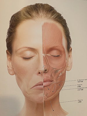 唇ヒアルロン酸