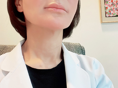 ACRS後ダウンタイム治療後の写真