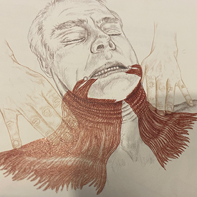 platysma広頚筋