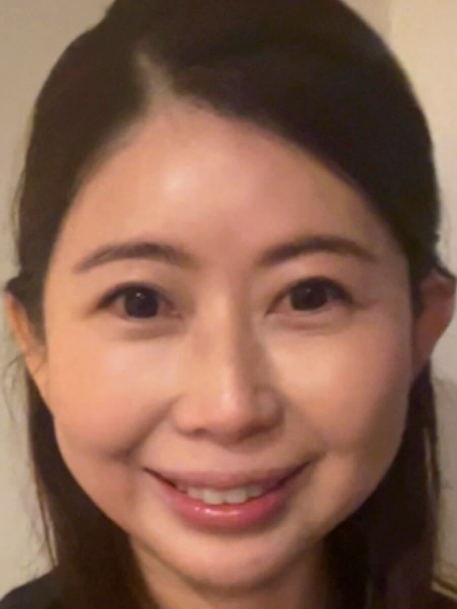 ヒアルロン酸溶解、修正後