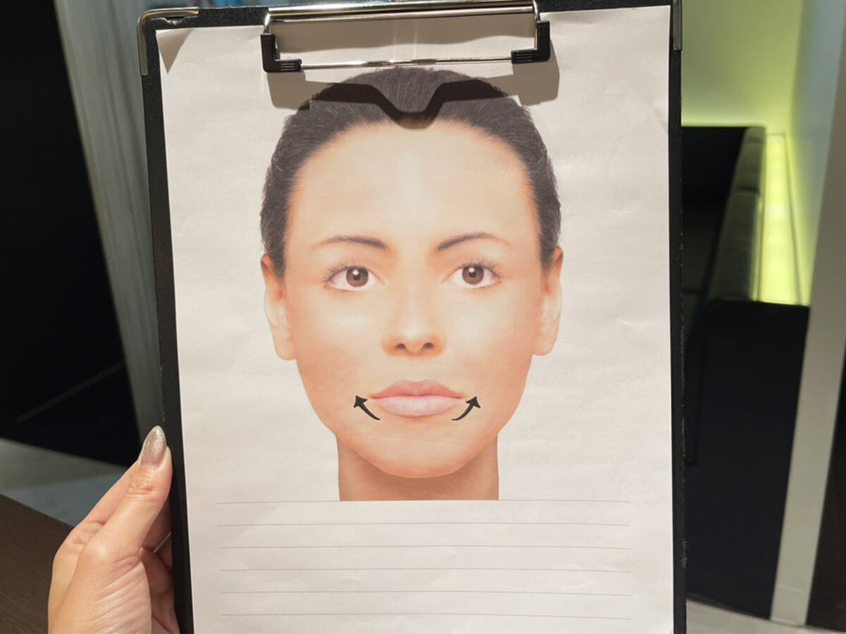 口角