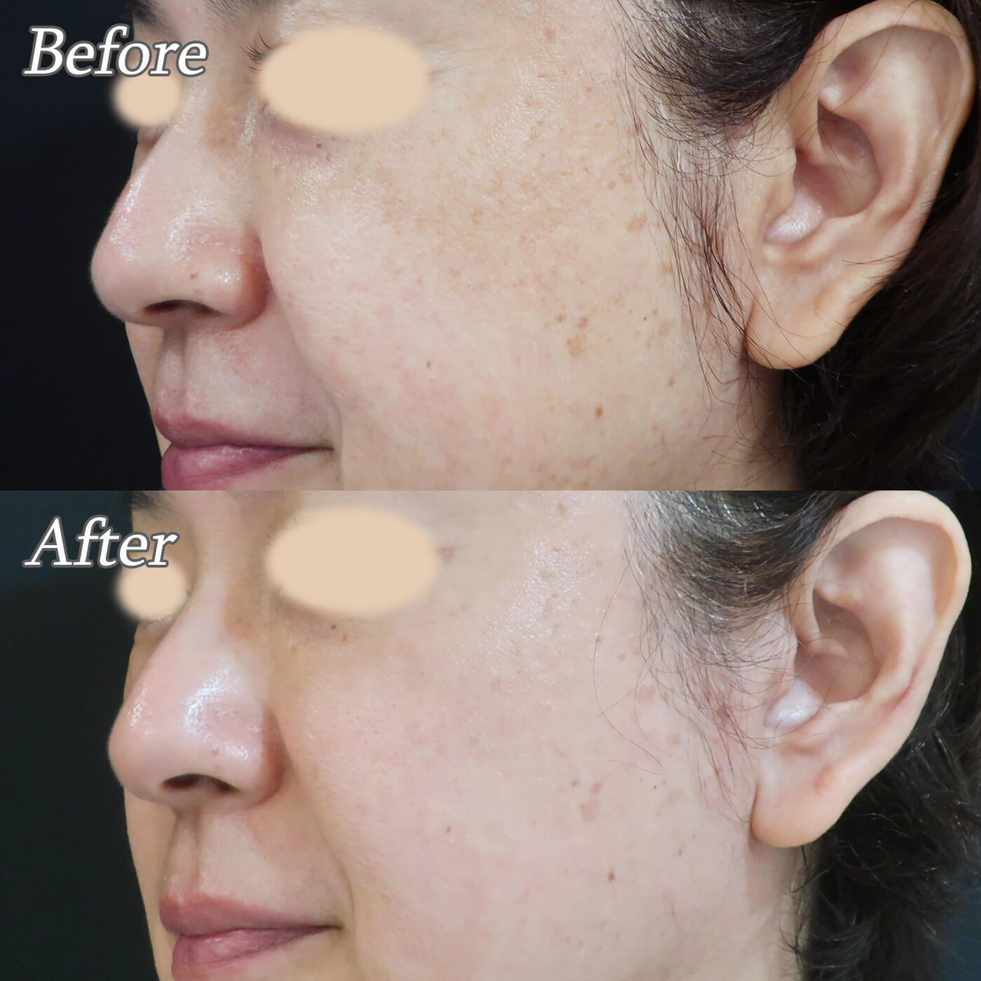 シスペラの効果