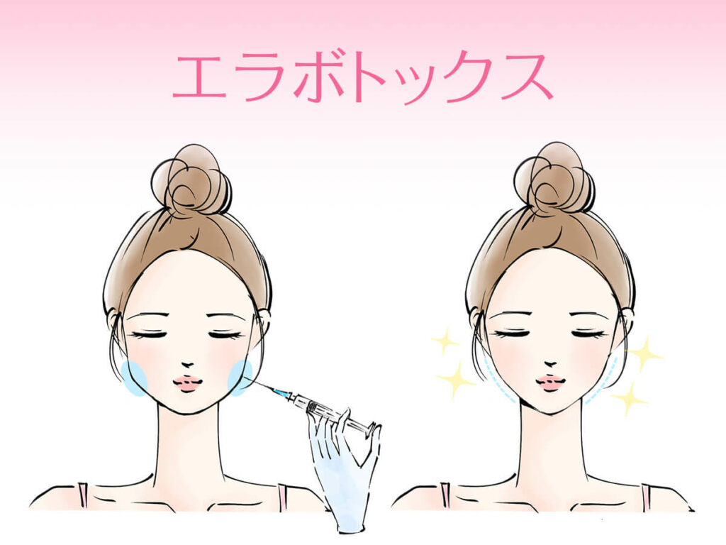 輪郭はボトックスで変わります！..