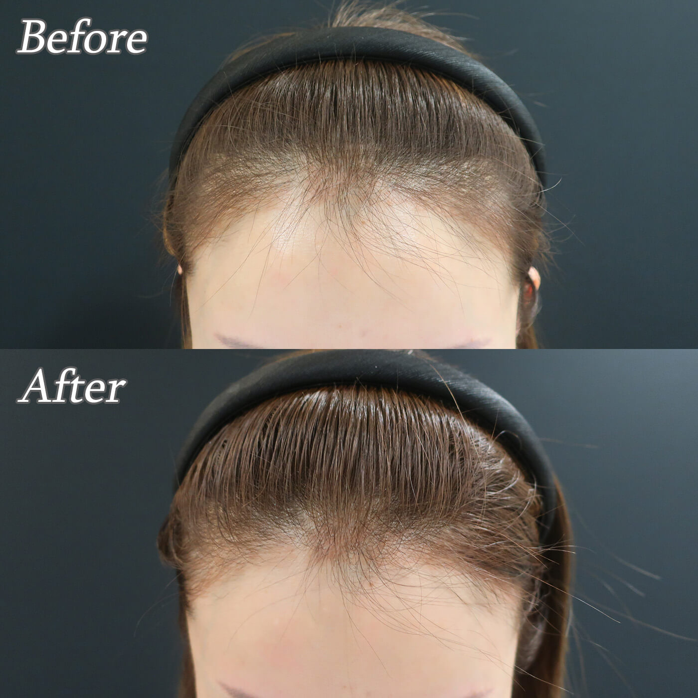 ヘアメンテナンスしませんか？育毛治療おすすめです♪　