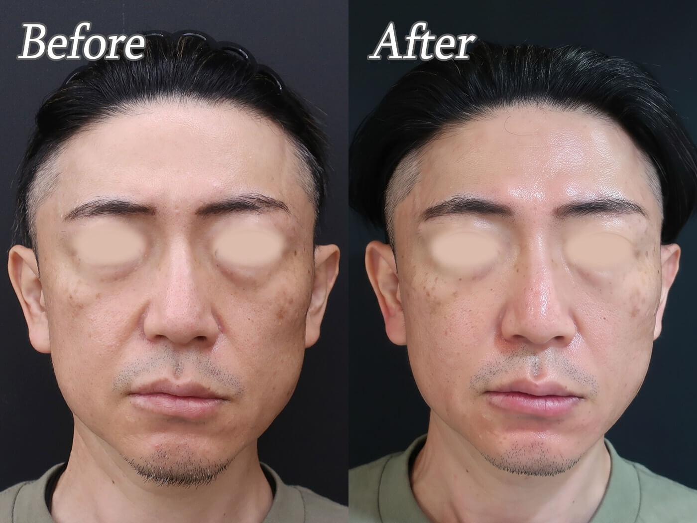 男性のアンチエイジング