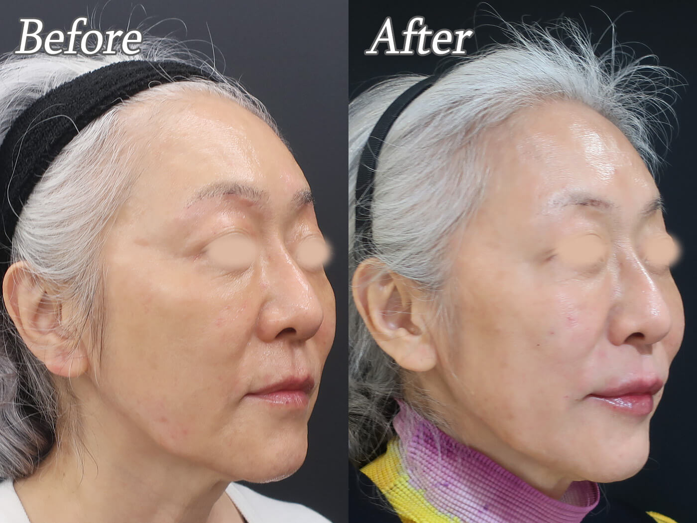 カウンセリングとカスタマイズ治療