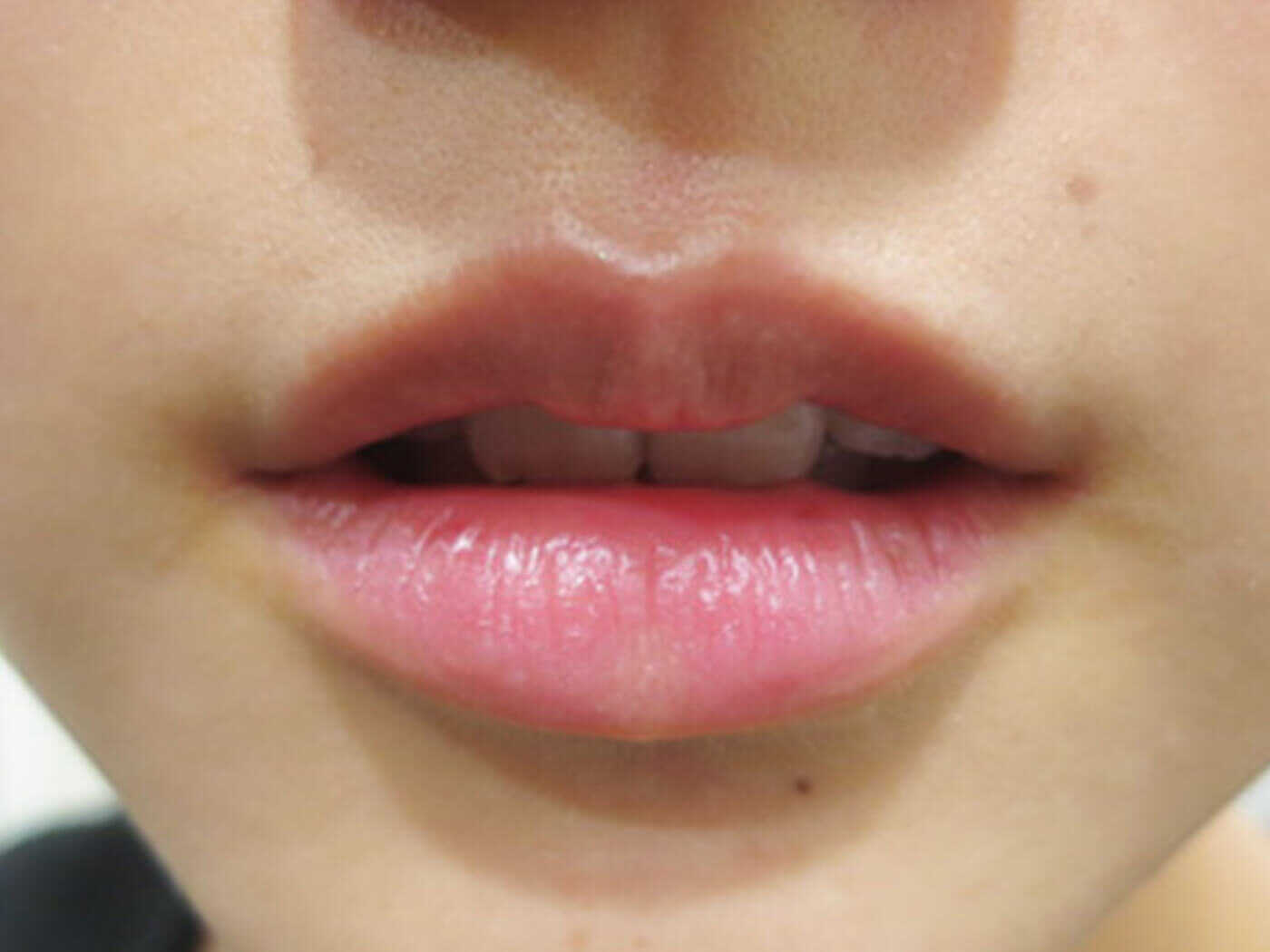 歯ブラシで唇を磨くと唇は大きくなりますか?