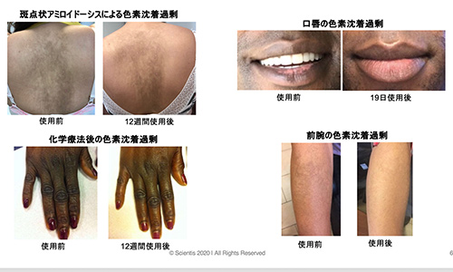 シスペラのボディへの使用と効果