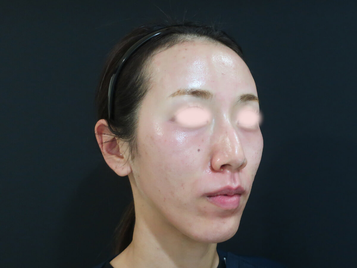 ポテンツァ直後