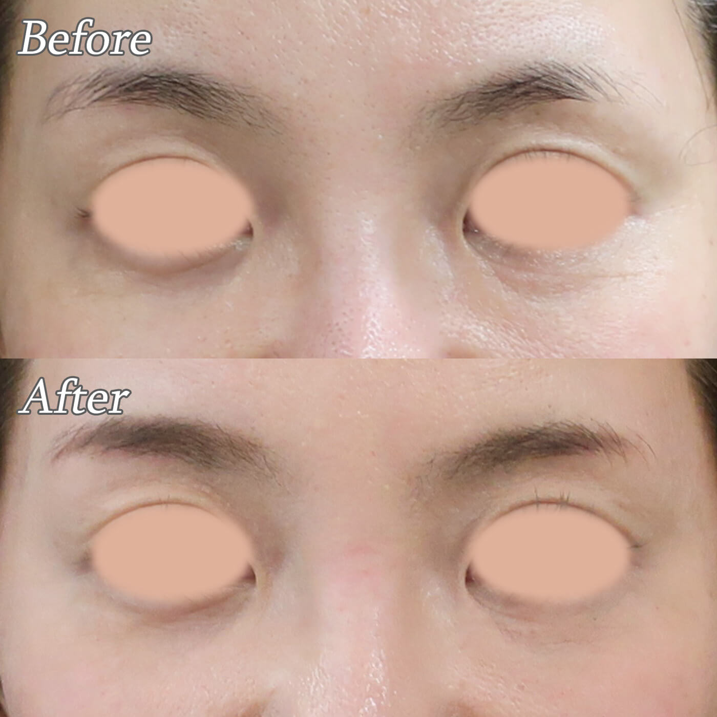 目元のプロファイロ