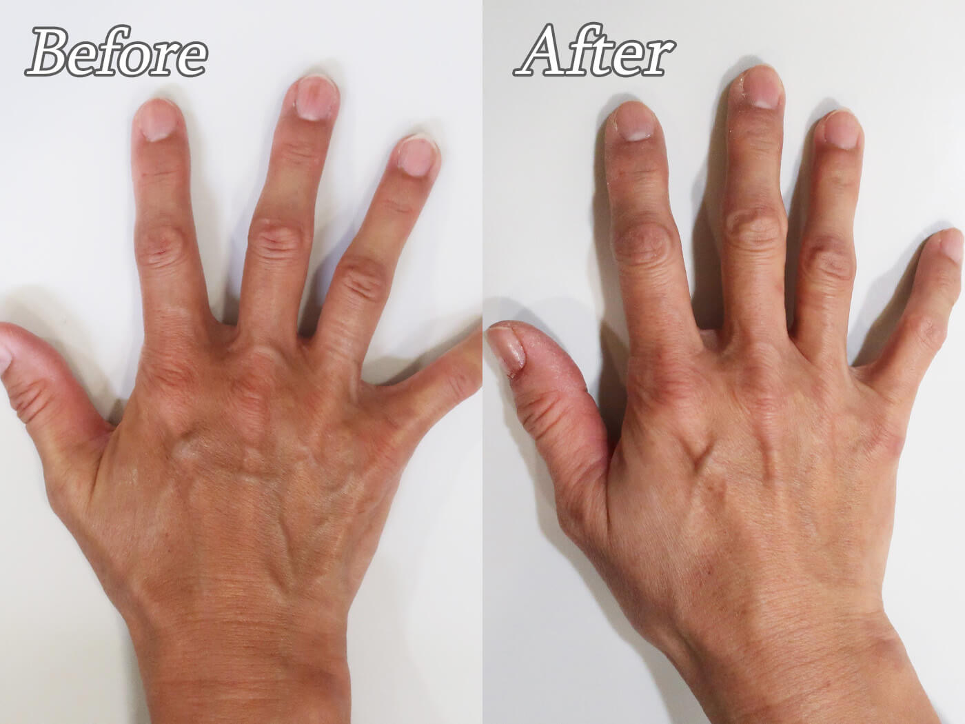 手のプロファイロ