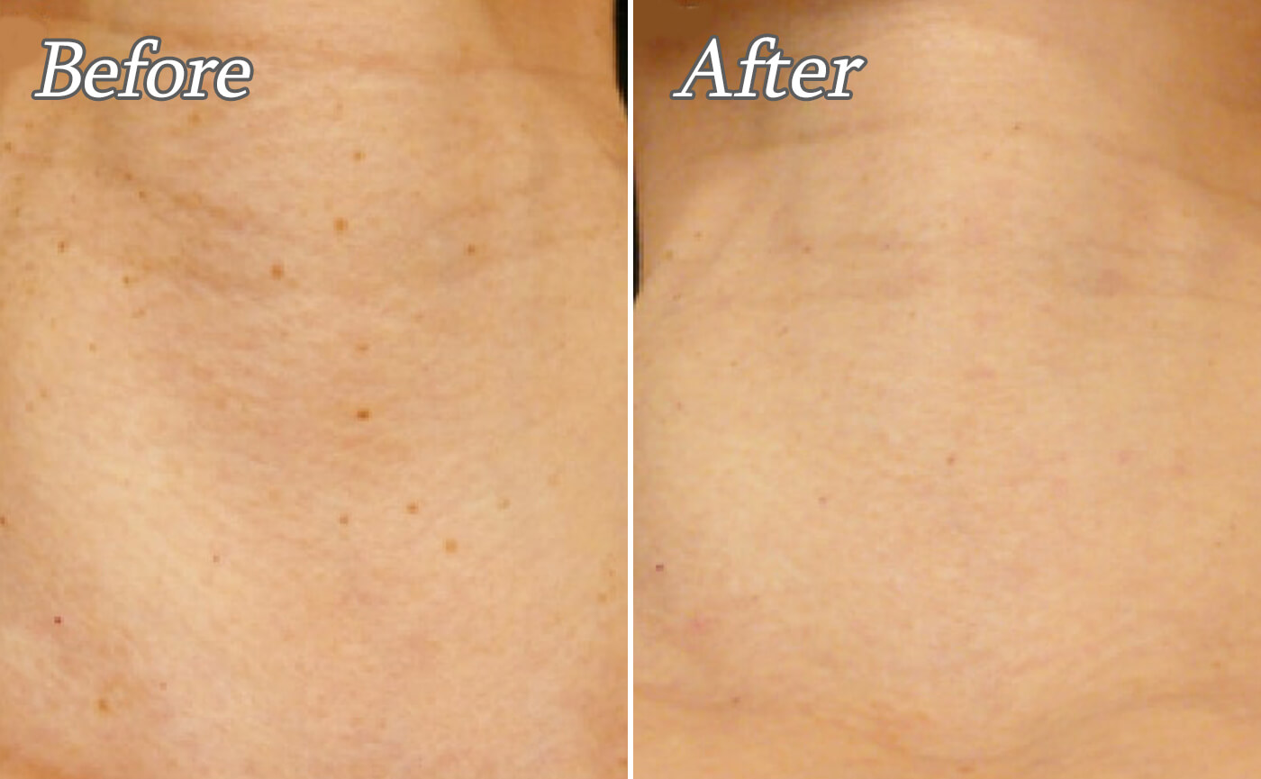 その首のポツポツ、ザラザラ取れますよ！！