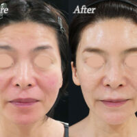 4年後の変化_正面